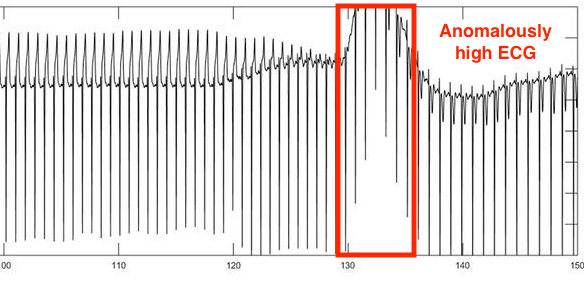 illustration of ecg